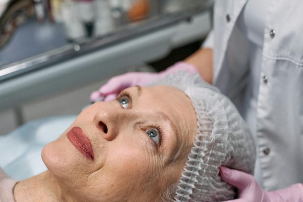 Moteris džiaugiasi natūraliais ir subtiliais veido bruožais po estetinės procedūros